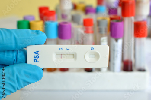 PSA testing by using test cassette, the result showed negative (single red line)