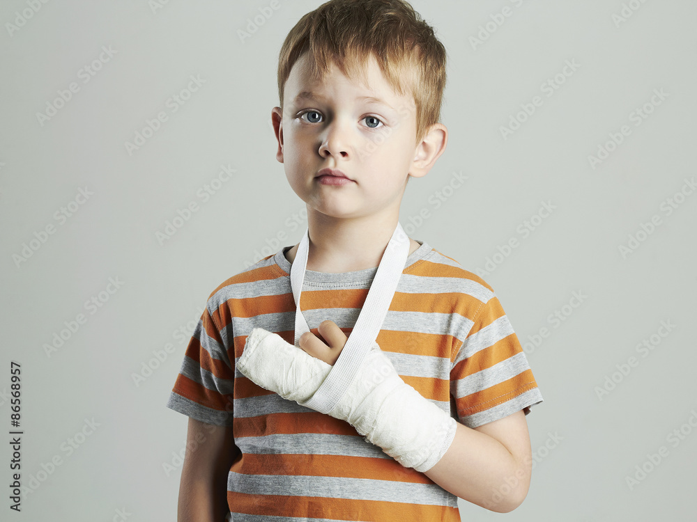 little boy in a cast.child with a broken arm.kid after accident Stock