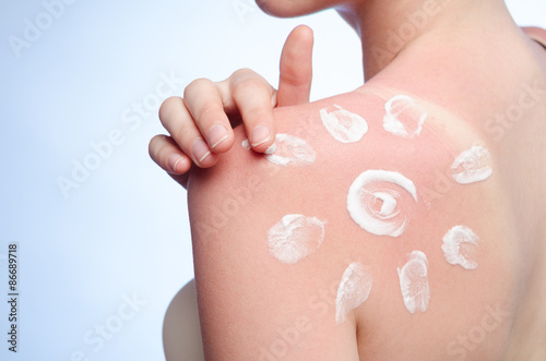 sunblock on the shoulder of a young woman