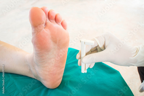 diabatic foot skining neuropathy photo