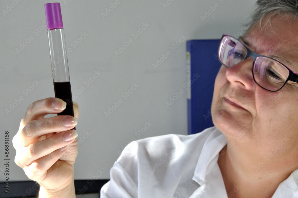Analyses sanguines Analyses sanguines