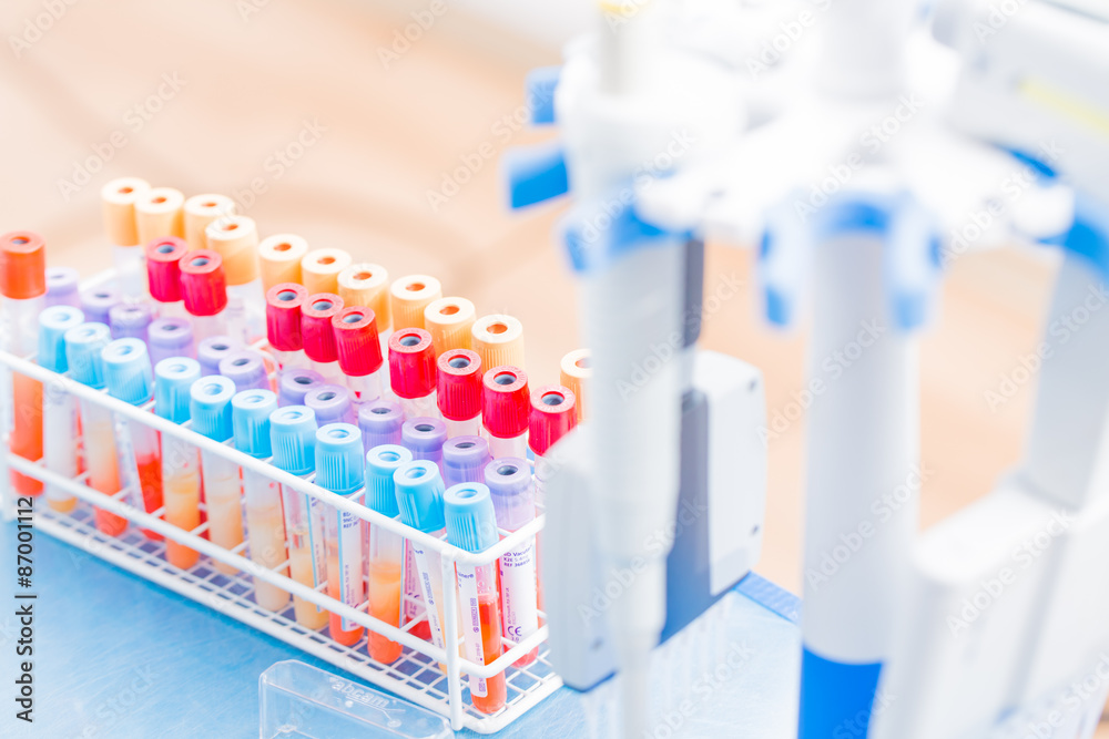 Berlin, Germany - May 15, 2014 : BD Vacutainer tubes, vacuum tub Berlin, Germany - May 15, 2014 : BD Vacutainer tubes, vacuum tub