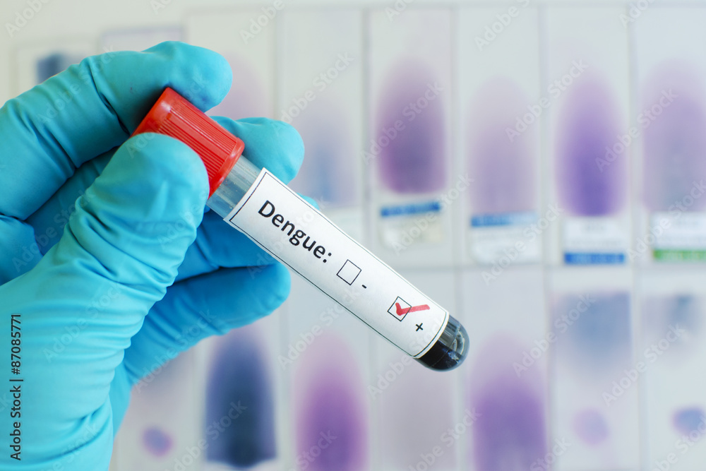 Fototapeta premium Dengue virus positive
