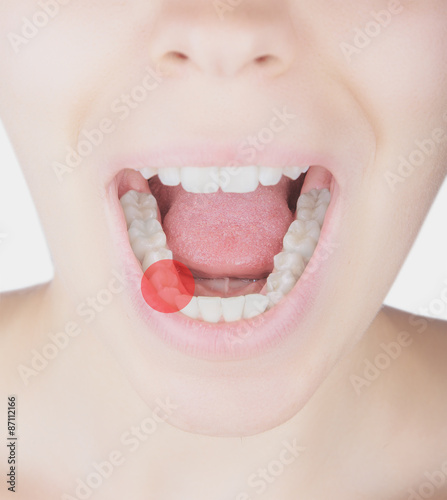 Dolore denti bocca