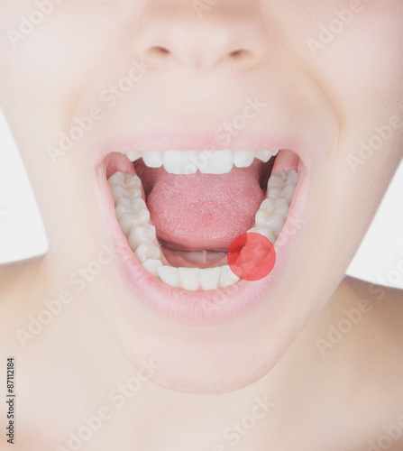 Denti donna dolore molare