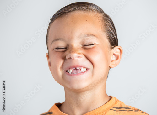 Child showing missing teeth.