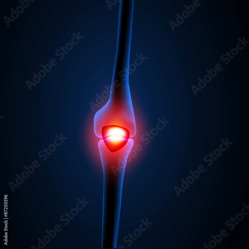 Painful Knee or leg X-ray, easy editable