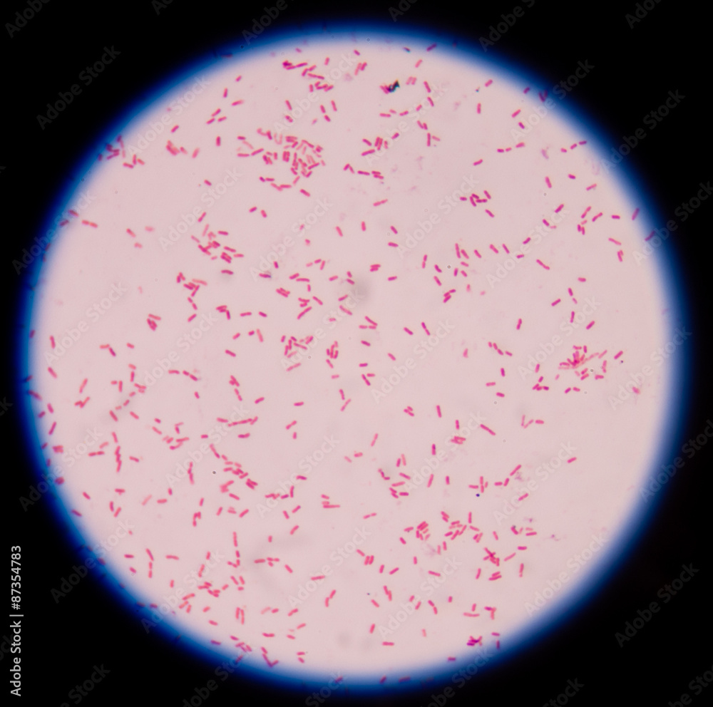Gram negative bacilli,Gram stain. Stock Photo Adobe Stock