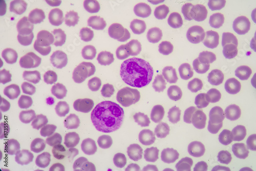 Blood cell formation from bone marrow