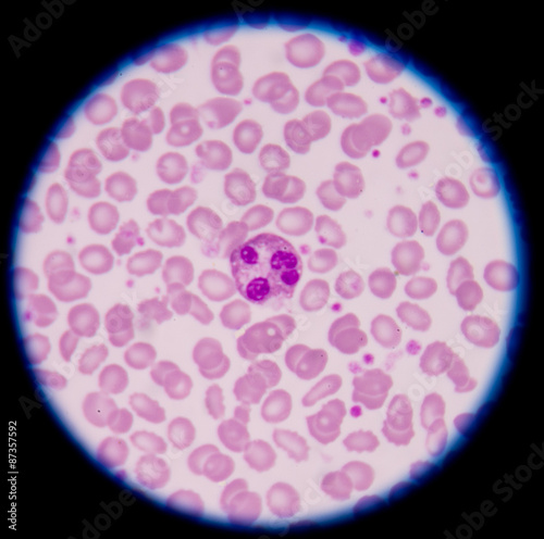 Fototapet White blood cells of a human, photomicrograph panorama as seen u