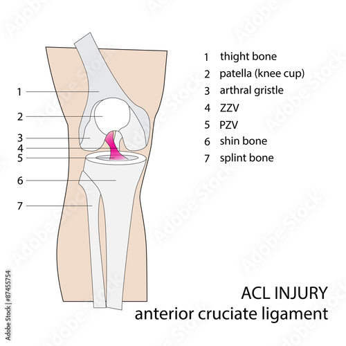 ACL. anterior cruciate ligament. vector format illustration.