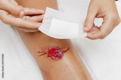 Person with fresh bleeding wounds on the knees The damage is treated with an adhesive bandage, to prevent the blood from flowing. Against white background, closeup,