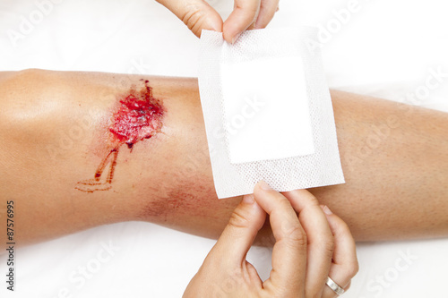 Person with fresh bleeding wounds on the knees The damage is treated with an adhesive bandage, to prevent the blood from flowing. Against white background, closeup photo