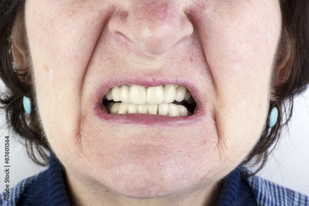 Fototapeta premium Elderly woman with new ceramic dentures