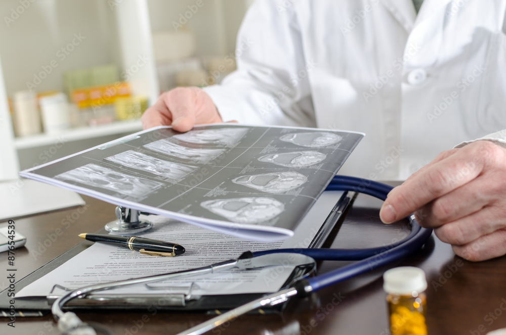 Fototapeta premium Doctor holding a MRI scan