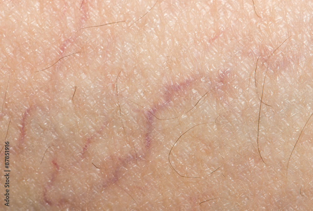 Fototapeta premium veins on the skin. close