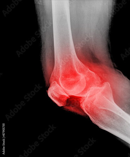 knee from the side, black background