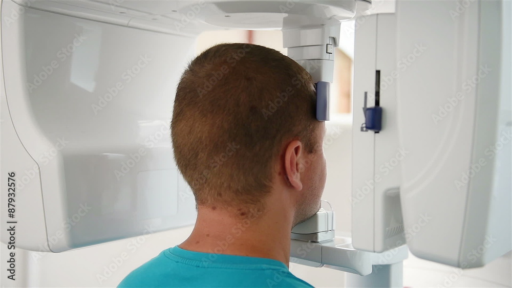 computer scans the patient's head, close up computer scans the patient's head, close up