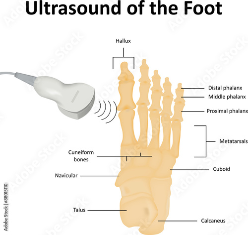Ultrasound of the Foot