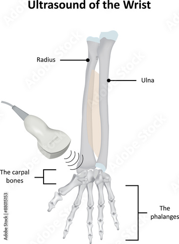 Ultrasound of the Wrist