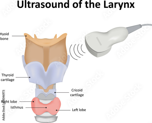 Ultrasound of the Larynx