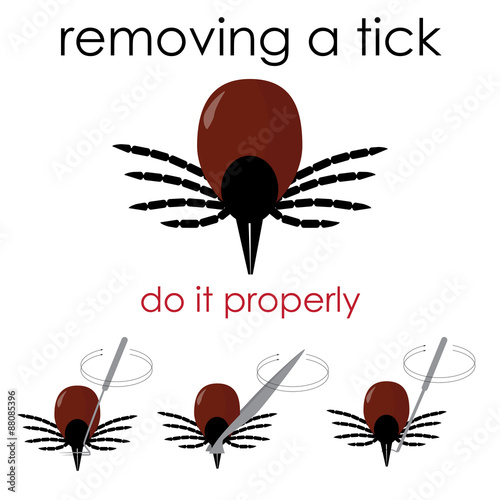 vector infographic illustration on how to properly remove a tick, and avoid lyme disease.