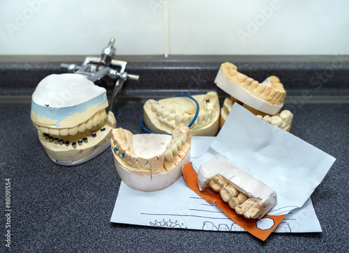 Dental molds for prosthetic teeth photo