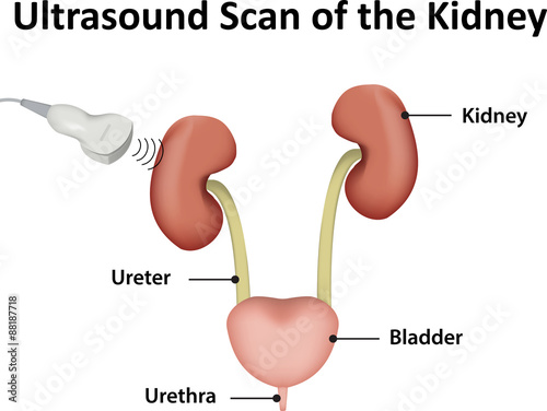 Ultrasound Scan of the Kidney