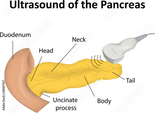 Ultrasound Scan of the Pancreas photo