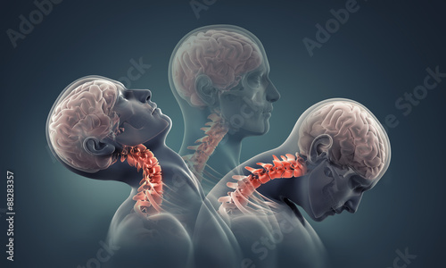 Fotografia man x-ray with neck bones highlighted