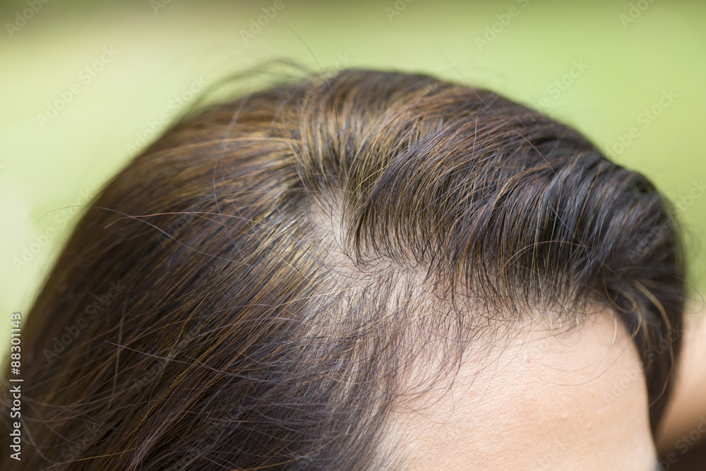 Young woman shows her gray hair roots Young woman shows her gray hair roots