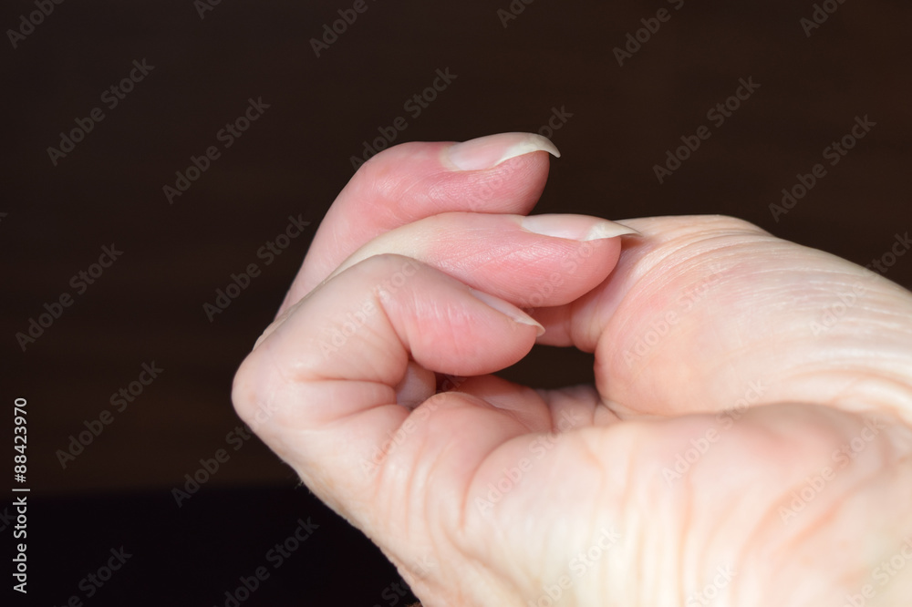 Female Fingers with Hooked Fingernail