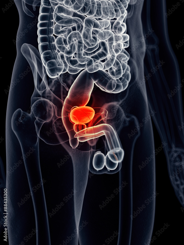 medically accurate illustration - painful bladder medically accurate illustration - painful bladder