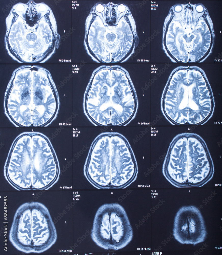 human head X-ray result human head X-ray result