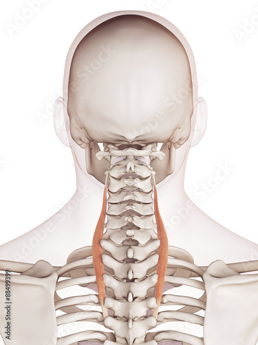 medically accurate muscle illustration of the longissimus cervicis photo