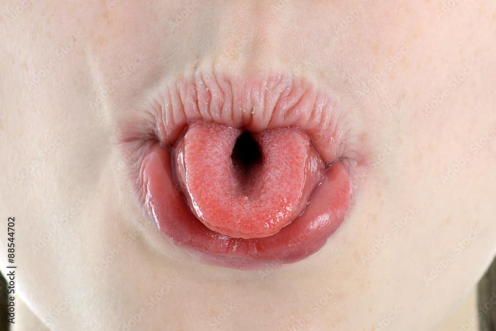 Zunge rollen als Übung und Therapie