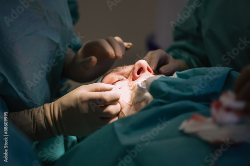 Plastic surgery of male blepharoplasty