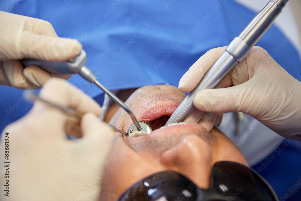 dentist hands treating male patient teeth