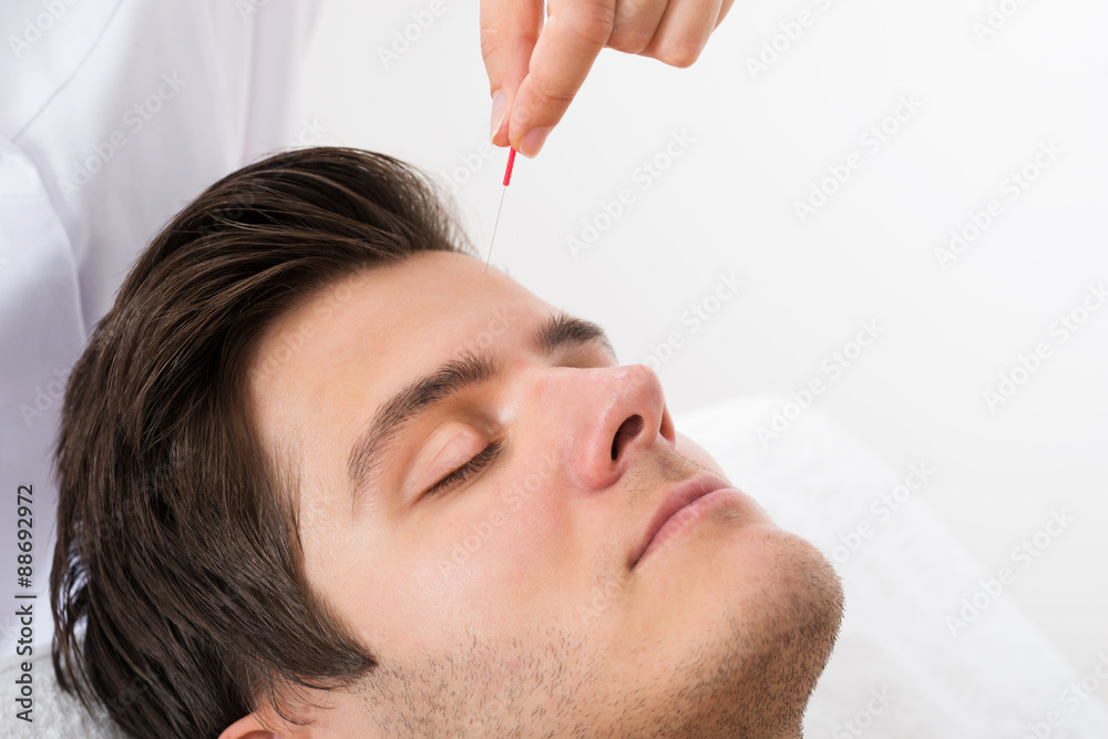 Man Receiving Acupuncture Treatment Man Receiving Acupuncture Treatment