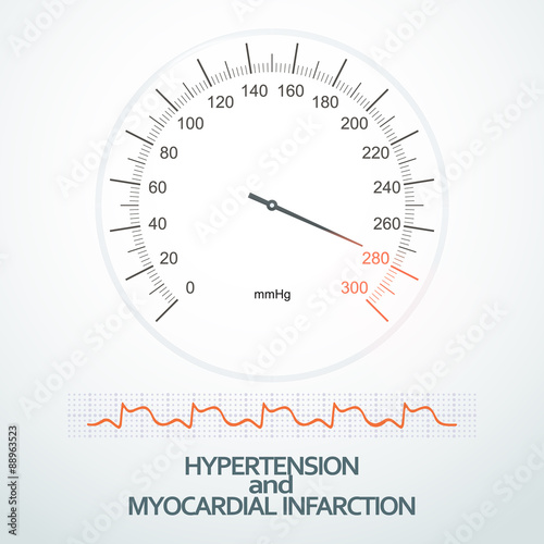 Hypertension on indicators of sphygmomanometer (tonometer) and m
