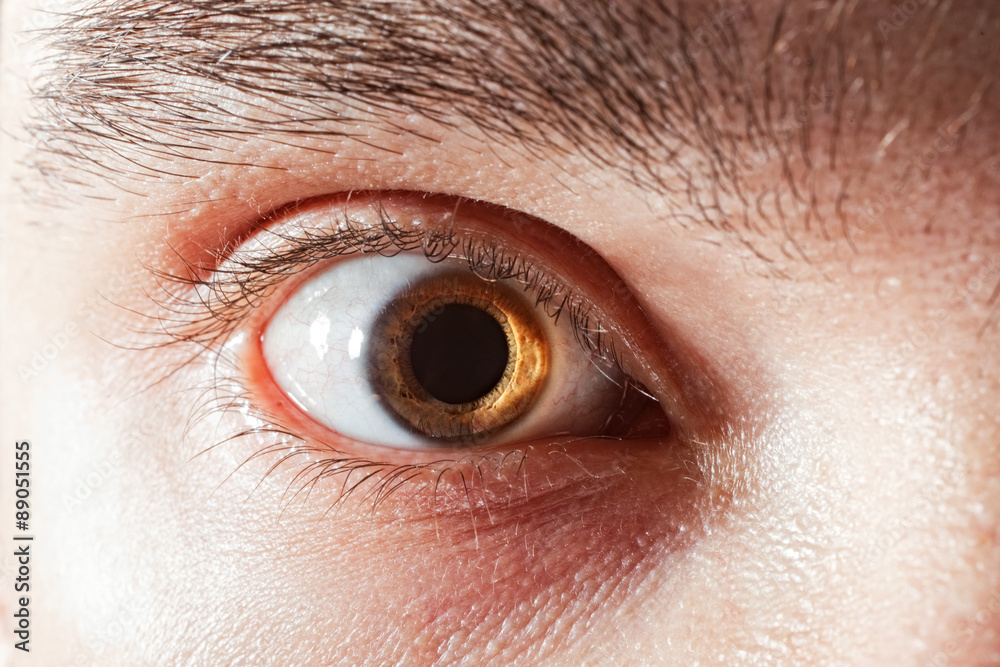 Fototapeta premium male eye with&nbsp;mydriatic pupil