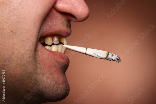 Bad teeth smoker