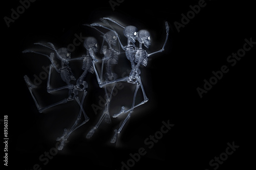 Dancing Skeletons X ray