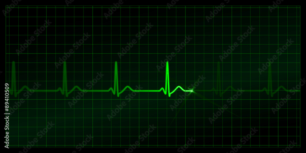 Cardiogram on the monitor. Green heartbeat line at black background. Vector medicine Illustration