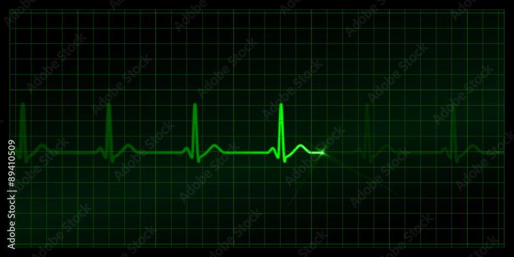Cardiogram on the monitor. Green heartbeat line at black background. Vector medicine Illustration Cardiogram on the monitor. Green heartbeat line at black background. Vector medicine Illustration