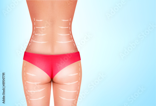 Lines, showing surgery on female body. Vector.