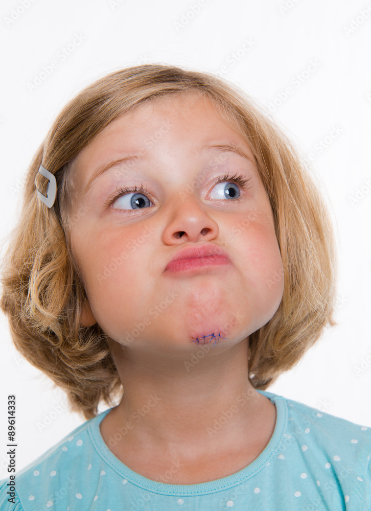 little white girl with wound in her face little white girl with wound in her face