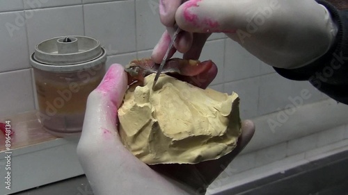 Place an old dentures making the plaster mold