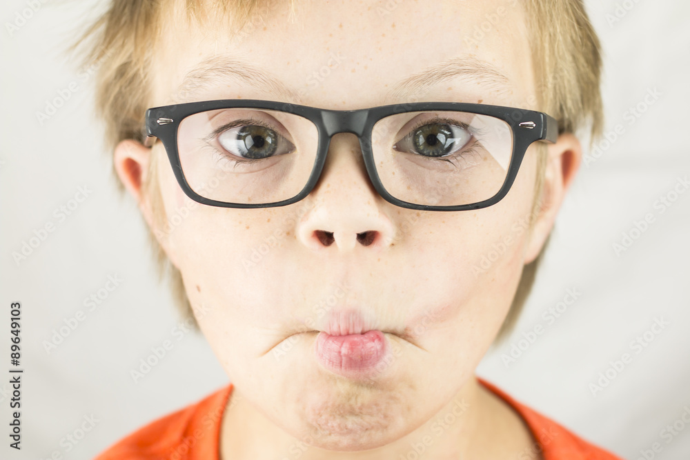 The Face of Downs Syndrome
