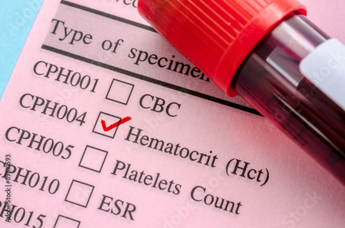 Hematocrit test blood. photo